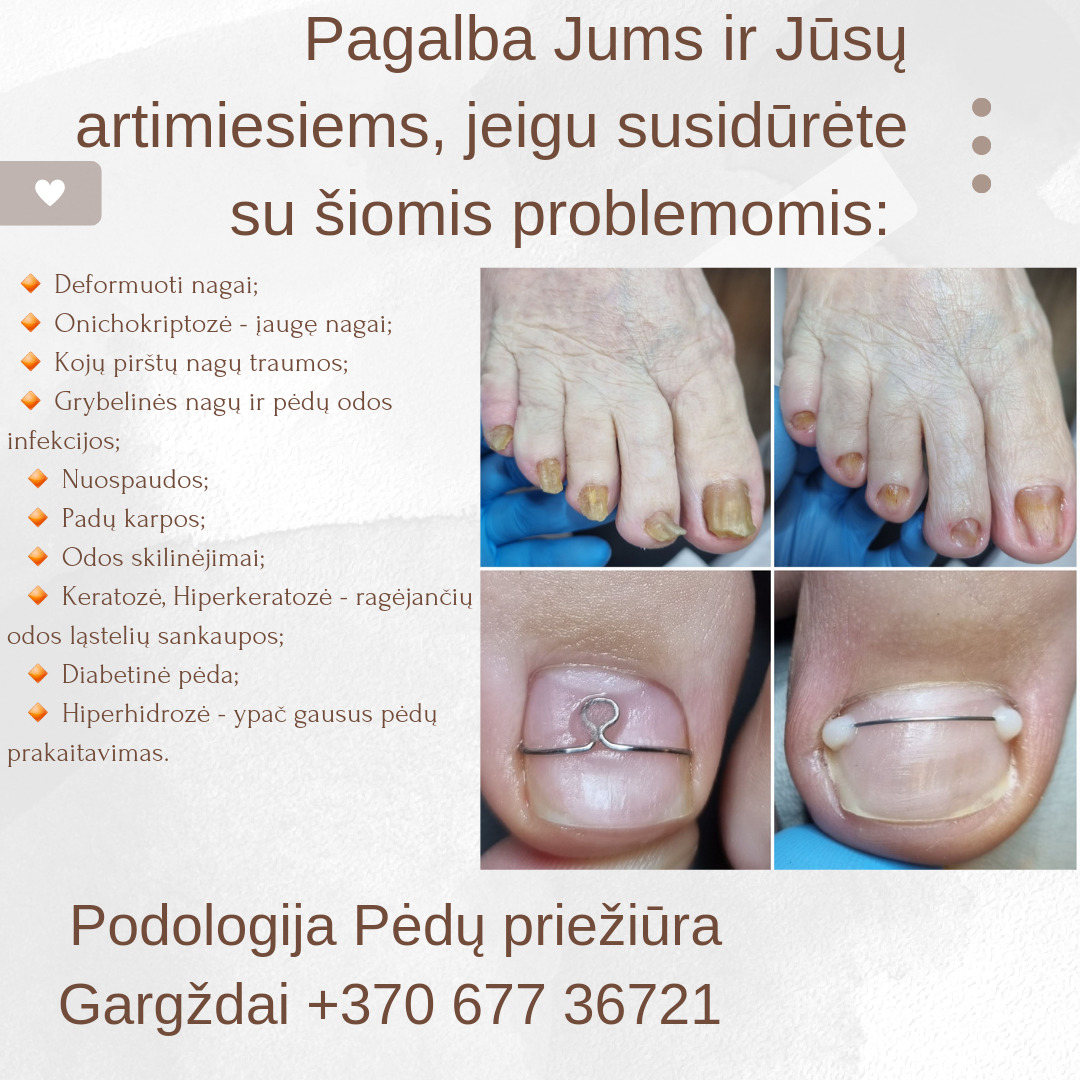Podologija – Pėdų priežiūra Gargždai